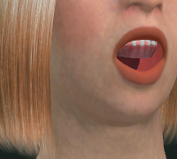 aa frame, mouth open on upper tooth row